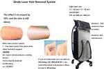 Ice Platinum Titanium Laser Removal Equipment 3 In 1 Hair Laser Machine 755nm