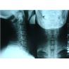 Buy cheap Translucent Inkjet X Ray Film Glossy Surface Silk Screen Printing from wholesalers