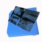 Discover 125 Micron Semi - Transparent White Laser Medical X - Ray PET Plastic