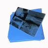 Buy cheap Discover 125 Micron Semi - Transparent White Laser Medical X - Ray PET Plastic Films For Medical Applications from wholesalers
