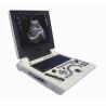 Buy cheap OB GYN Portable Color Doppler Ultrasound Machine In Pregnancy from wholesalers