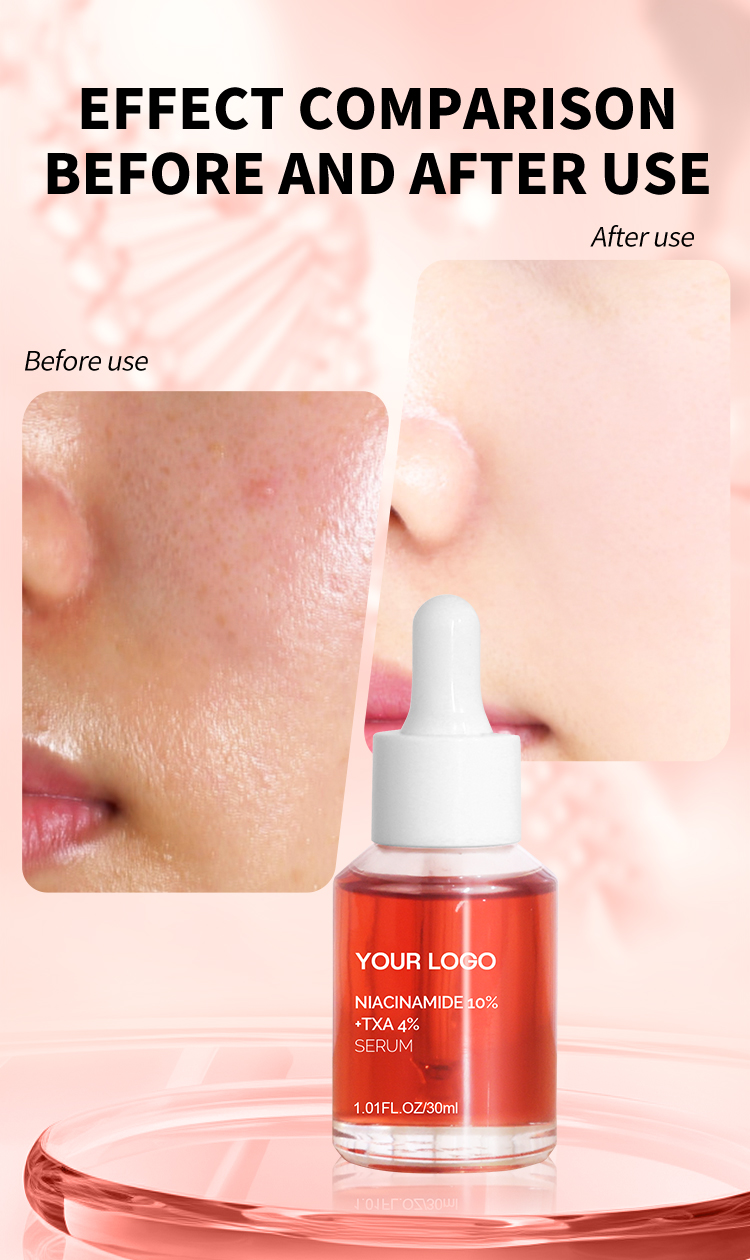 Private Label Niacinamide 10 and Txa 4 Serum Dark Spot Aha Organic Moisturizing Rejuvenating Niacinamide Face Care Serum