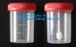 Sterile Disposable Hospital Sample 60ml 100 120 Ml Test Measurement Collection