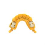 10ml Strength Permanent Crown Materials For Dental Crown Restoration