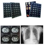 Professional Epson Waterproof Inkjet Printer X Ray Film For Water Based Dye /