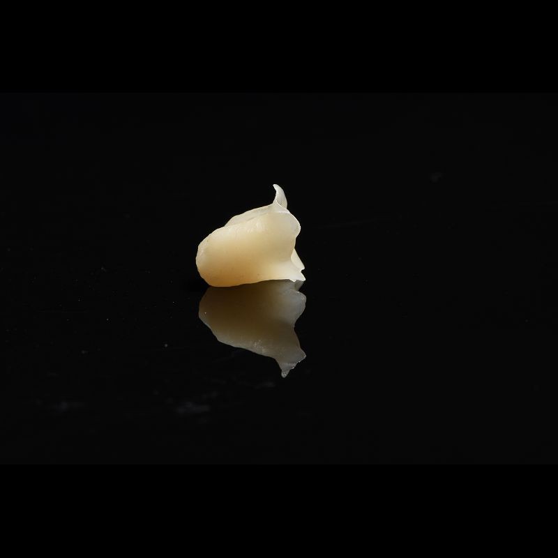 Metal Free Composite Crowns Inlays And Onlays Bridges Implants ODM