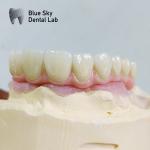 Universal Dental Implant Case Compatible With Multiple Implant Systems