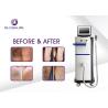 Buy cheap Skin Tightening Lady Hair Removal Machine Ipl Hair Removal System Ce Approval from wholesalers