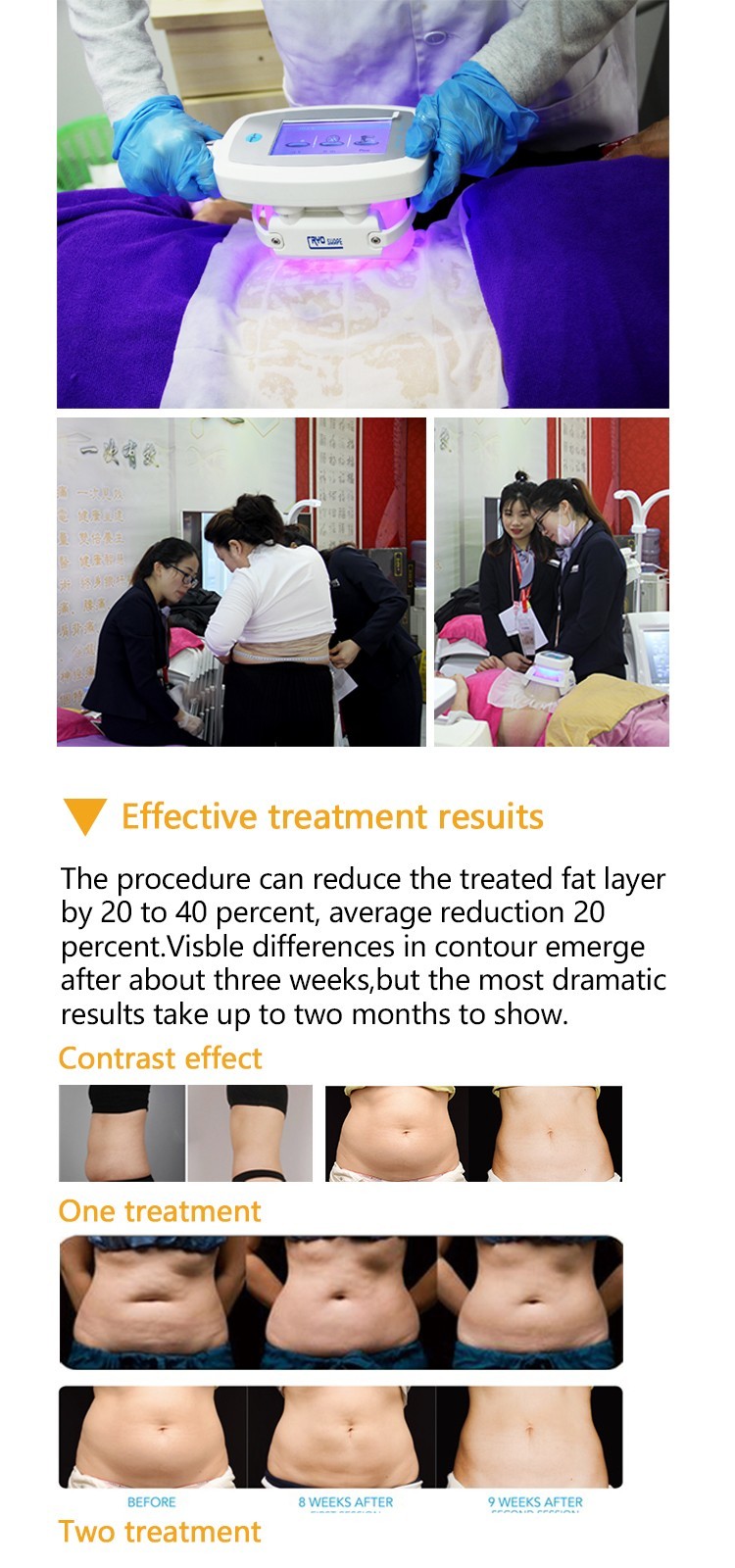 LF-223 Portable Dual Handles Cavitation RF Ice Therapy Machine/ Cryotherapy Slimming Equipment