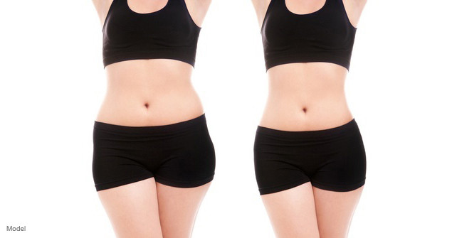 Ultra Slim Belly Fat Removal Machine , 1000W Cryogenic Lipolysis Machine