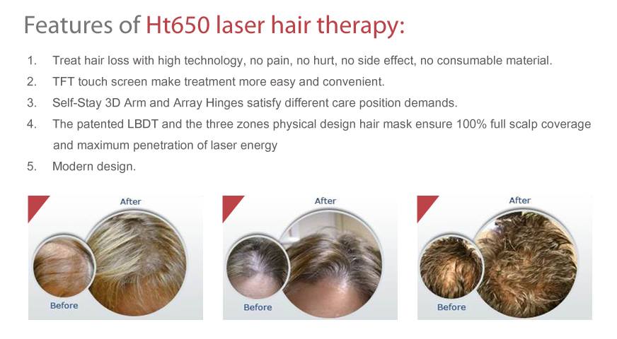 Beauty Hair Laser Regrowth Machine Diode Photodynamic Therapy Device 650nm