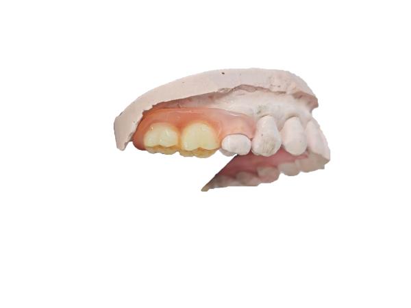 Strong and Durable Gardening Simulation Resin for High Aesthetic Orthodontic