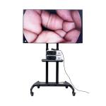 3840x2160p Ultra 4K Endoscope Camera Medical Monitor 55inch