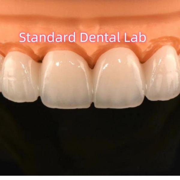 Buy cheap Zirconia Crowns Bridge Dental Lab With Layered Porcelain from wholesalers