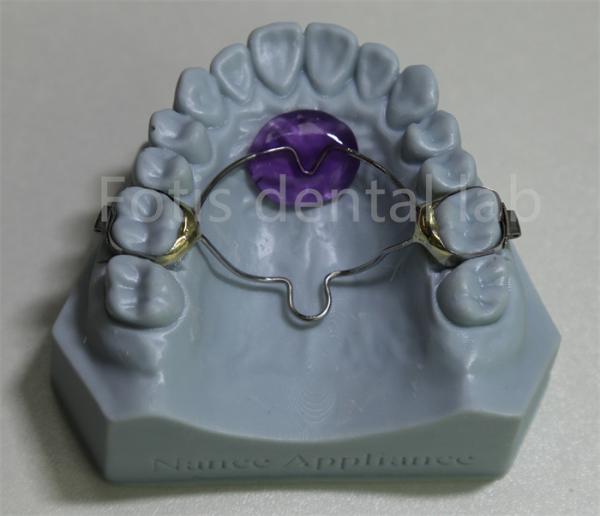 Buy cheap Dental Lab Affordable Orthodontic Expander Retainer Effective In Retaining And Expanding Teeth from wholesalers