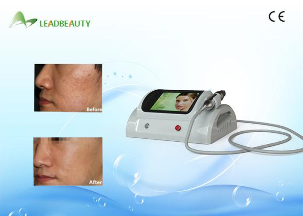 Buy cheap Fractional RF Microneedle Anti-wrinkle Beauty Machine with three types needle from wholesalers