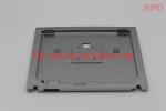 Medical Health Die Casting Parts Sliver Painting Screen Frame Monitor Parts Ra0