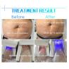 Buy cheap 4 handles Cryo Therapy Cool Sculpture Zeltiq cryolipolysis machine 2018 from wholesalers