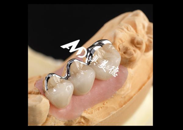 Buy cheap Strong PFM Porcelain Fused To Metal Crown Excellent Biocompatibility Wear Resistance from wholesalers