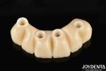 Dental Restoration Ti-Base Zirconia Hybrid Bridge Natural Looking Precise Fit