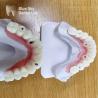 Buy cheap Dental Multi Implant Cases Customized Implant Procedure Cases from wholesalers