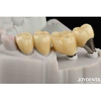 Buy cheap Natural-looking Implant Crown And Bridge Safe For Oral Long Lasting Performance product