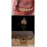 Buy cheap 4-6 Dental Endosseous Tapered Implant Subcrestal Bone Level And Internal Hex Connection from wholesalers