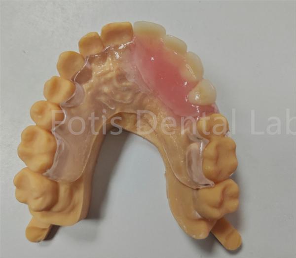 Buy cheap Hypoallergenic Comfort Fit Flexible Valplast Partial TCS Dental Appliance from wholesalers