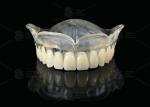 Heat Curing Vertex Thermosens Dentures For Clear Full Denture Wearers