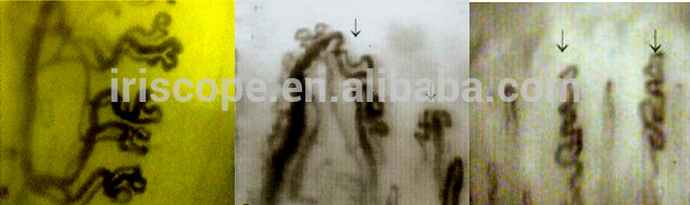 CE Approved LCD Screen Medical Microscope Capillary Microcirculation