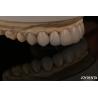 Buy cheap Feldspathic Natural Looking Cosmetic Veneers Precise Fit Highly Translucent from wholesalers