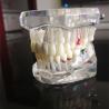 Buy cheap Removable Dental Materials Activity Pathological Teeth Model from wholesalers