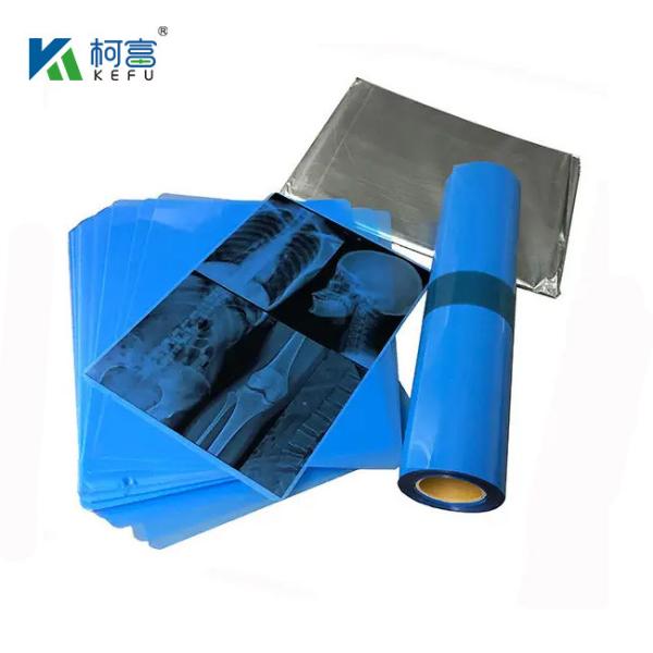 175mic 215mic High Definition Medical Imaging CT DR Inkjet Blue Film Medical X