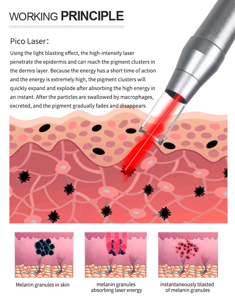 Picosure Laser Tattoo Removal Pico Laser Tattoo Removal Nd Yag Laser Tattoo Removal Machine