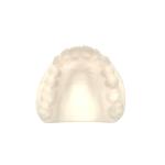 Flexibility Strength Dental Resin 3d Printing