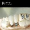 Buy cheap Single Crowns Zirconia Abutment Hypoallergenic Dental Implant Zirconia Abutment from wholesalers