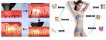 2500W Germany 808nm Diode Laser Hair Removal Beauty Clinic Equipment