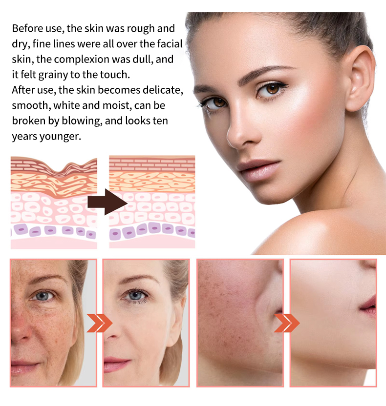 5 In 1 Skin Care Serum Dark Spot Whitening Serum Vitamin C Facial Serum