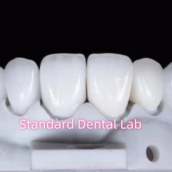 Buy cheap Natural Looking Restorations Aidite Dental Zirconia Tooth Crown from wholesalers