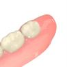 Buy cheap Natural Looking Denture Bases Biocompatible Resin Optimal Patient Comfort from wholesalers