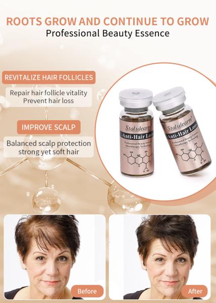 Buy cheap Best Quality Anti Hair Loss Care Treatment Scalp Care Prevent Hair Loss Hair Growth Serum from wholesalers