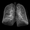Buy cheap Eco-Friendly Medical Dry Film Agfa 2B X Ray With CT Machine from wholesalers