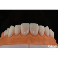 Buy cheap A1-A4 Ips Emax Press Porcelain Dental Veneers Stain Resistant Customizable Shape product