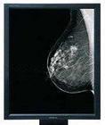 850cd/m2 Typ Brightness Medical Grade Displays 20.1" Size G51SP