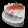 Buy cheap High Esthetics Dentsply Lucitone 199 Acrylic Denture acrylic resin for dentures China Dental lab from wholesalers