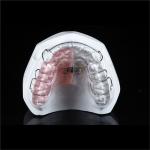 Mouth Orthodontic Expanders Adults Plate For Dental Alignment