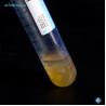 Buy cheap Reduce Inflammation Platelet Rich Plasma Tube PET 50ml For OA Treatment from wholesalers