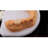 Buy cheap Translucency Zirconia Dental Inlay Onlay Crown For Restore Natural Cavity Shape product