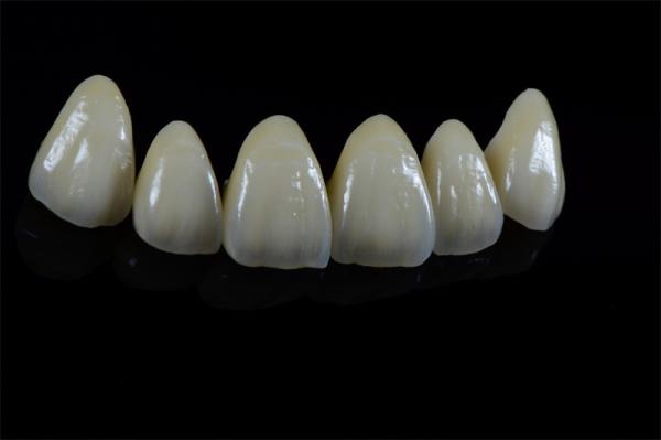 Buy cheap Natural Looking Aesthetic Ceramic Emax Veneer Dental Material Customized from wholesalers