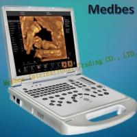 Buy cheap Portable 4D Color Doppler Ultrasound Scanner product